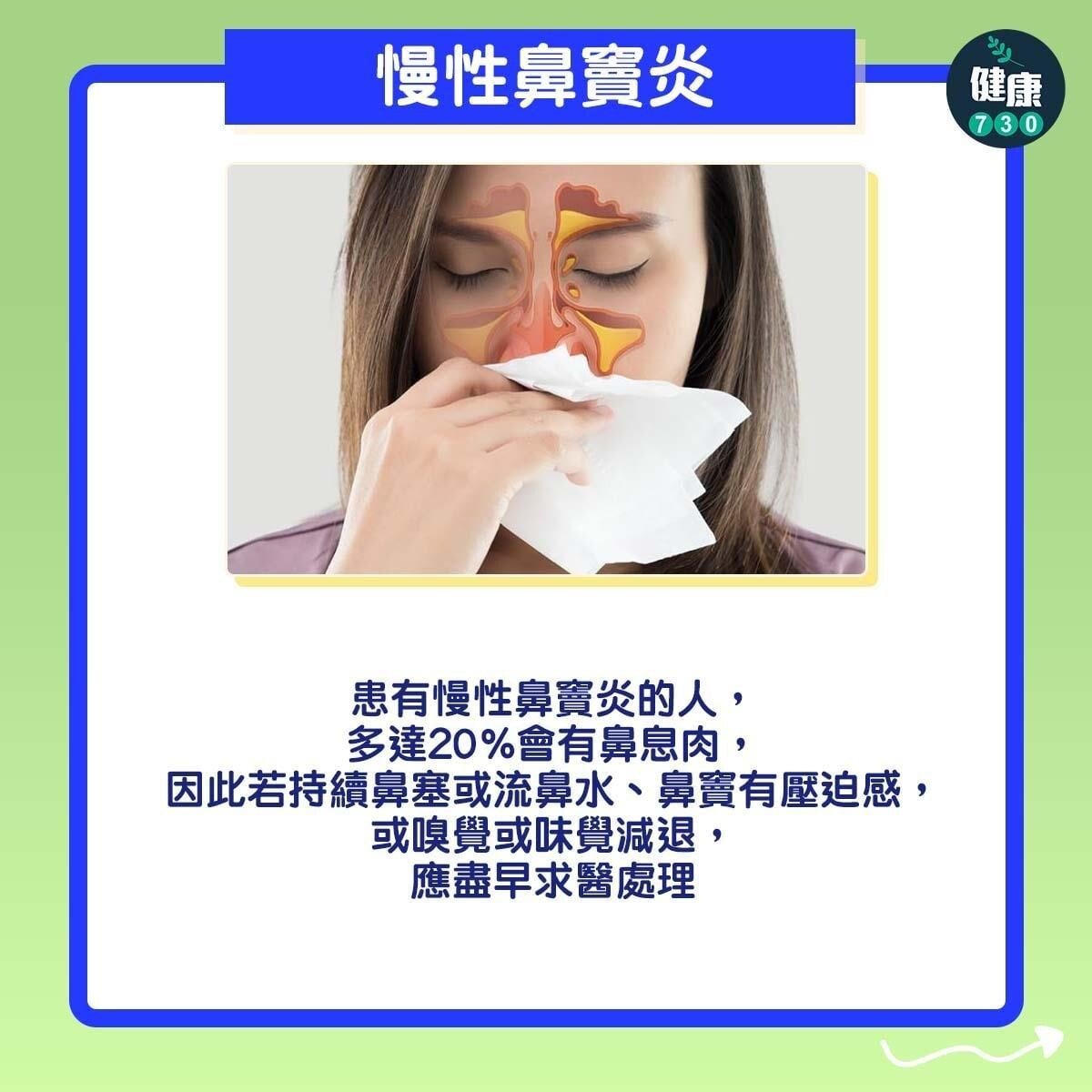 鼻塞原因｜哮喘、慢性鼻竇炎、藥物敏感、過敏性鼻炎都可能是成因。（am730製圖）